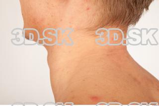 Neck texture of Alton 0007